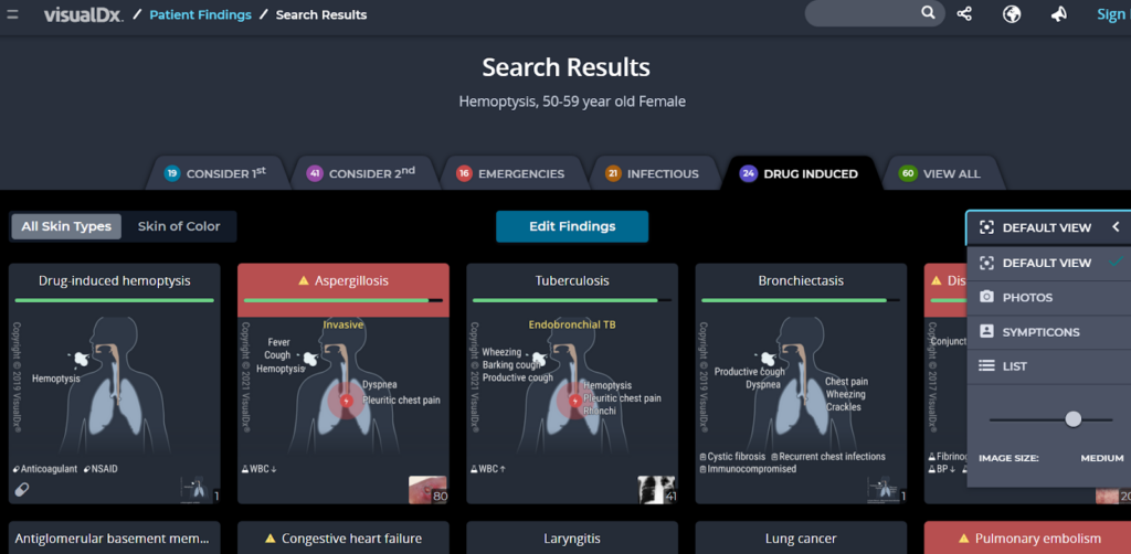 Screenshot of visual dx showing search results for hemoptysis, 50-59 year old Female